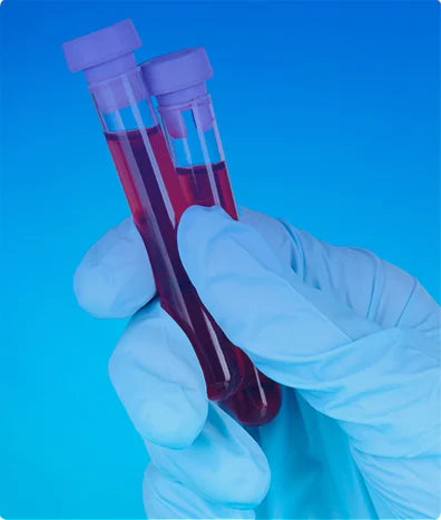 REACCIONES FEBRILES EN SUERO