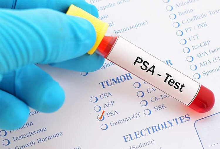 ANTÍGENO PROSTÁTICO ESPECIFICO TOTAL Y LIBRE EN SUERO