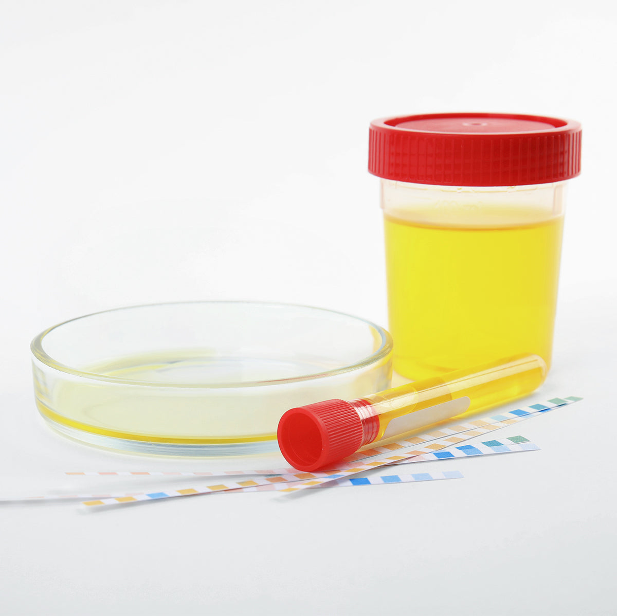 CULTIVO DE ORINA (UROCULTIVO) – Laboratorio Coriv